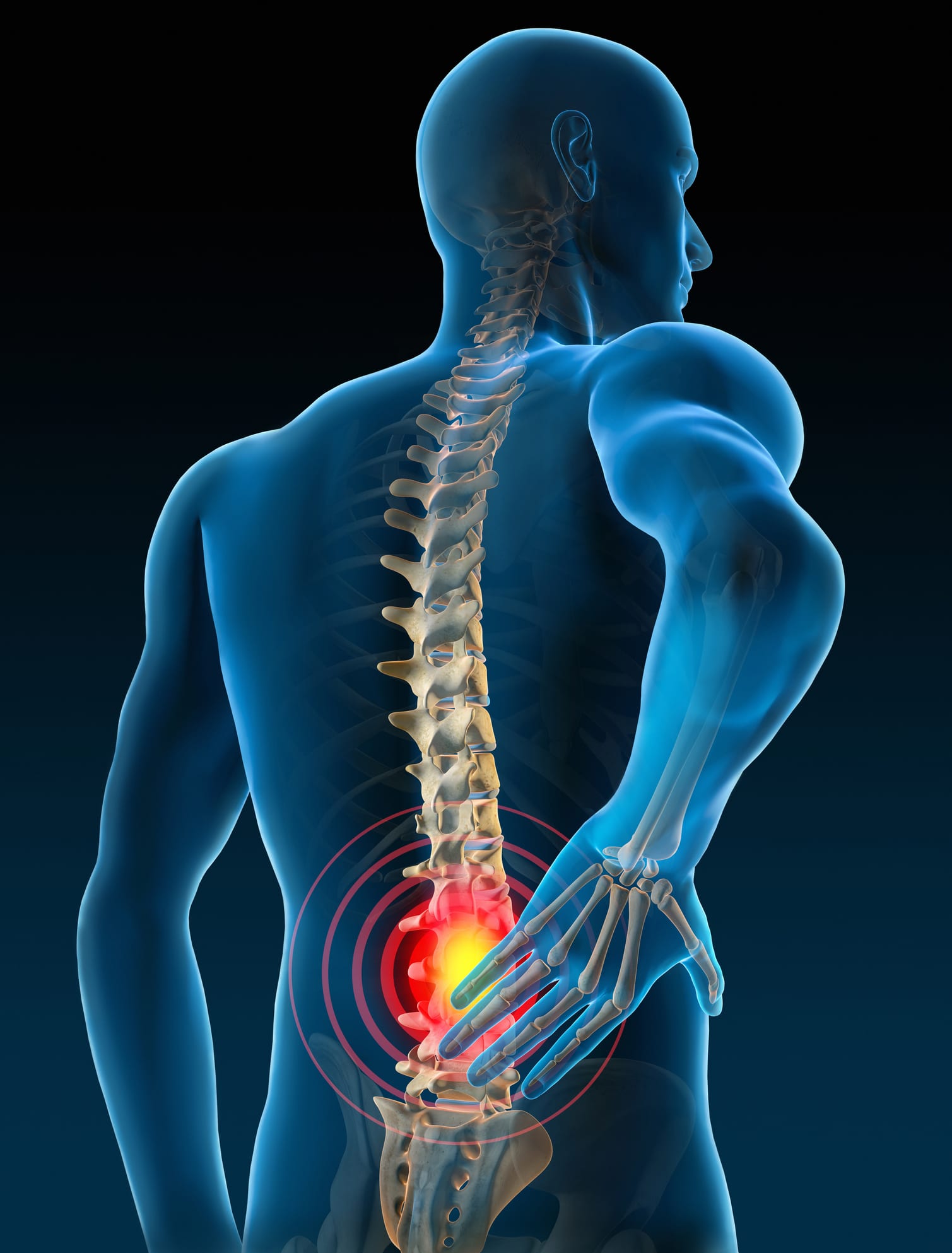 Slip and Fall Lawyer in St Louis - Slip and Fall Injury - Can I for a Slip  and Fall?